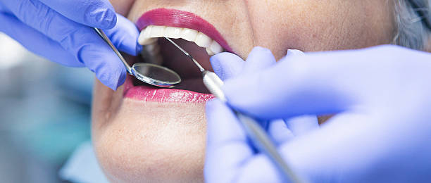 Best Emergency Dentist for Knocked-Out Tooth in Cudahy, CA